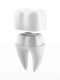 pediatric dental crowns