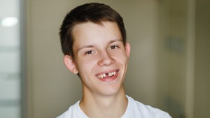 What to do when a tooth is knocked out, concussed tooth and can you put teeth back in