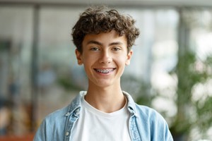 Why teens need to see the dentist regularly, sports mouth guards, dental sealants for kids and teeth whitening for teens
