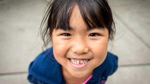 missing primary teeth in children