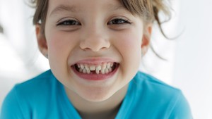 Should Parents Encourage Wiggling Loose Teeth
